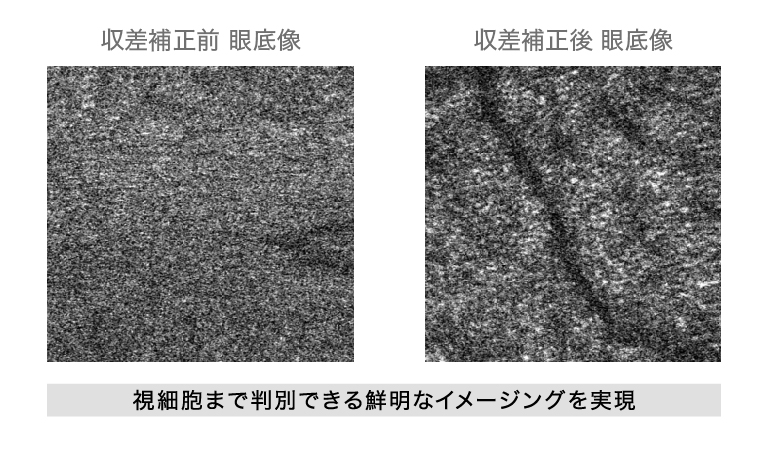 眼底カメラでの収差補正前後の比較